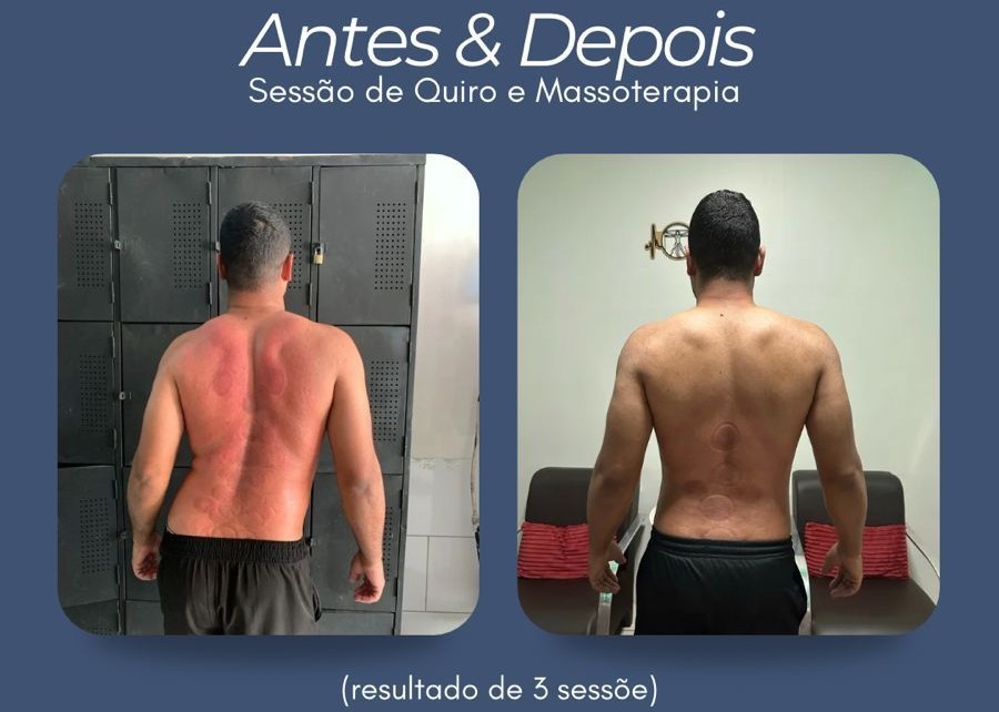 Sessão de massoterapia 1