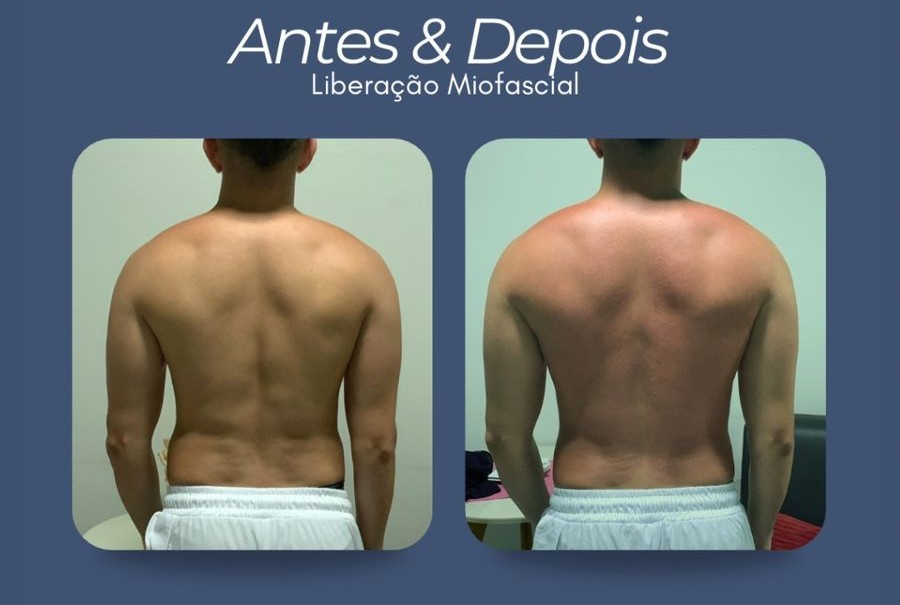 Sessão de massoterapia 2