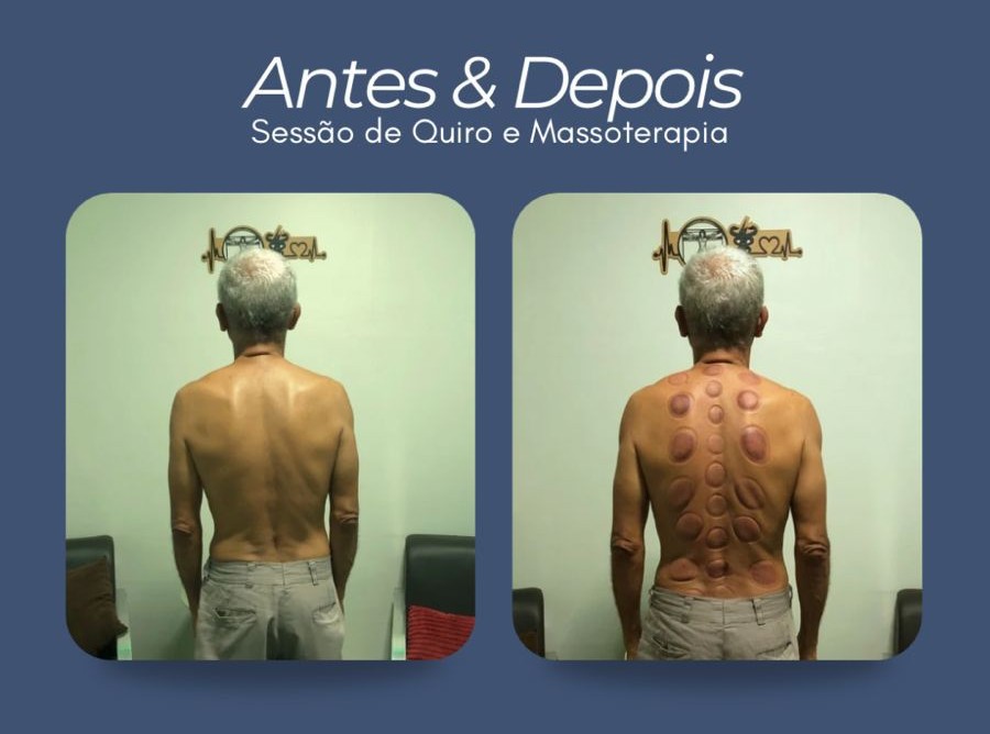 Sessão de massoterapia 3